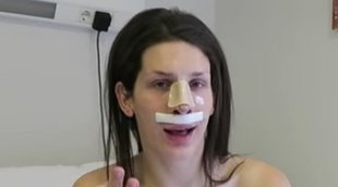 Oto Vans se opera la nariz: "Es un hecho muy fuerte para mí"