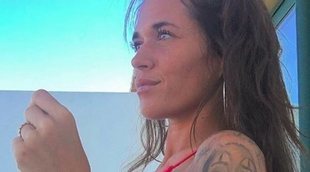 El 'accidente' de Fiama tras hacerse un tratamiento facial