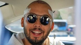 Primeras imágenes de Avilés tras someterse a un injerto capilar