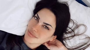 Barber, en el hospital tras fracturarse la pierna en la nieve