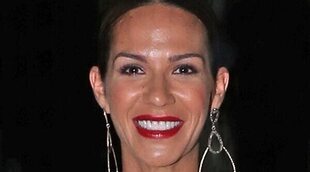 Tamara Gorro pierde mucho cabello por su depresión