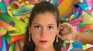 Miri Pérez enseña la evolución de sus heridas tras su accidente