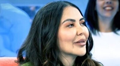 El cambio radical de Patricia Donoso: así ha quedado tras una operación estética