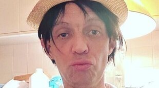 Camilo Blanes impacta con su nueva imagen sin dientes