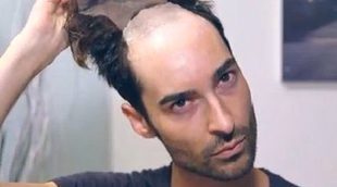 ¡Increíble! Miguel ('GH17') enseña al mundo su nuevo rostro