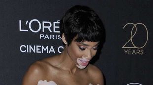 El descuido de Winnie Harlow en Cannes 2017