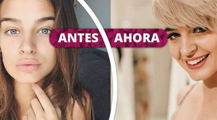 ¡Quién te ha visto y quién te ve, Laura Escanes!