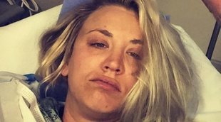 Kaley Cuoco, operada en plena luna de miel