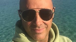 Dinio renueva su imagen y se una a la moda del injerto capilar