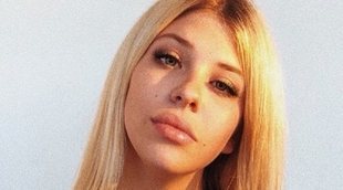 Anita Matamoros resuelve el misterio de sus labios hinchados