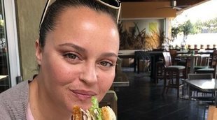 Shaila Dúrcal enseña la rehabilitación de su mano tras perder parte de un dedo