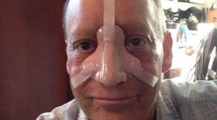 Muere Steve Bean a causa de un raro cáncer de nariz