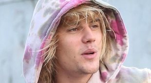 Justin Bieber comparte una ecografía en Instagram