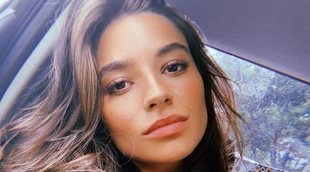 Crusset comparte muy natural cómo luchó contra el acné