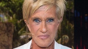 Las secuelas que sufre Chelo tras haber adelgazado 34 kilos