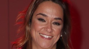 Toñi Moreno muestra la marcas de su caída