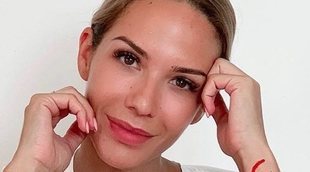 Tamara elimina el hirsutismo facial que le provocó el embarazo