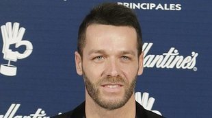 Leo Cámara muestra cómo le ha quedado su injerto capilar