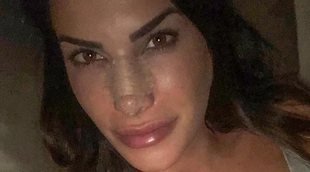 Carla Barber retransmite en directo su operación de estética