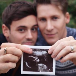 Tom Daley y Dustin Lance Black enseñando la ecografía de su primer hijo