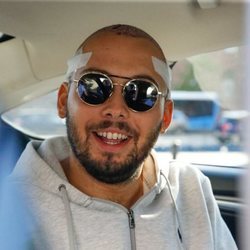 José Antonio Avilés muy feliz tras someterse a un injerto capilar