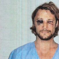 Gabriel Aubry muestra su rostro tras la pelea con Olivier Martínez