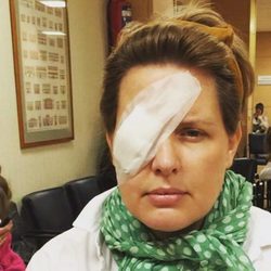 Tania Llasera con un parche en el ojo